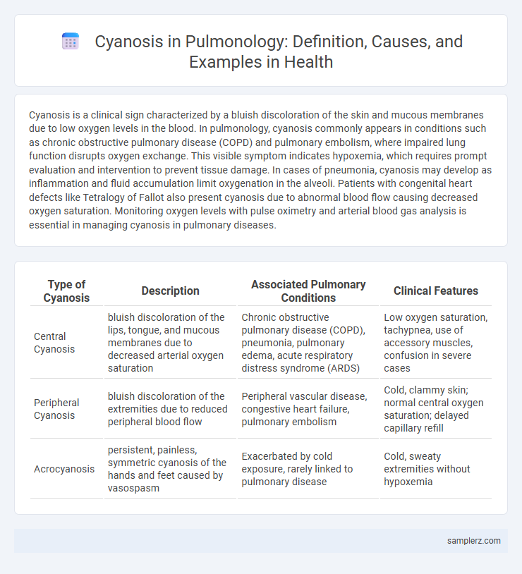 Cyanosis in Pulmonology: Definition, Causes, and Examples in Health